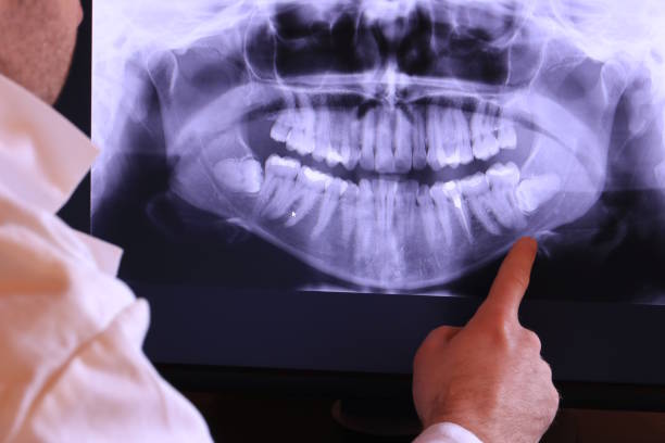 Best Holiday Emergency Dentist in Lindsborg, KS