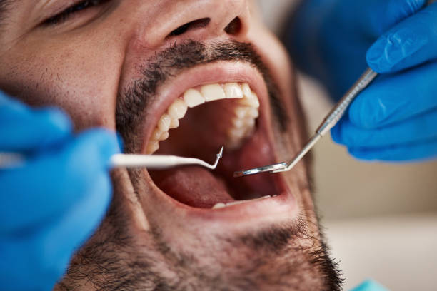 Best Weekend Emergency Dentist in Lindsborg, KS